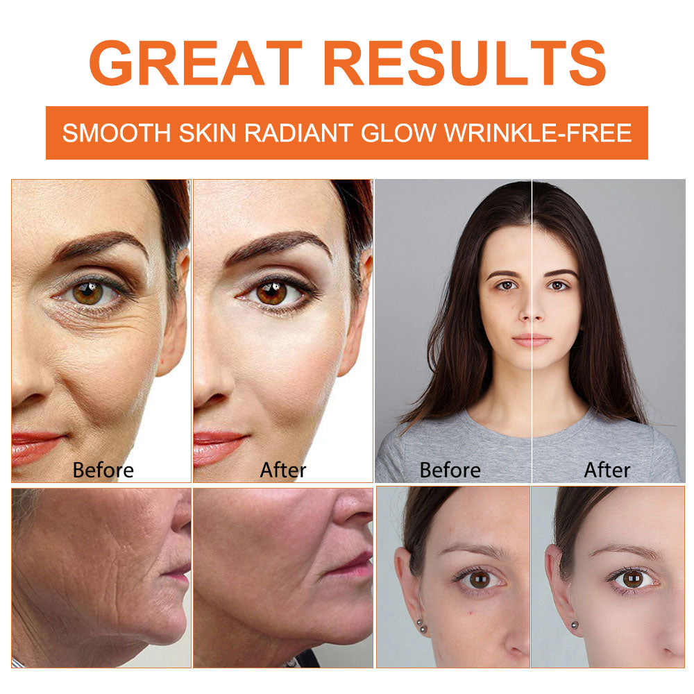 BOIUOITI VITAMIN C 20% ANTI AGING SERUM FOR SKINCARE