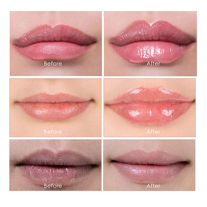 Aliver LIP PLUMPER Set-Sine, Moisturize & Plump 2Pcs/Set
