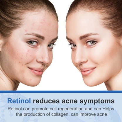 Gudthycapae ADVANCED RETINOL CREAM