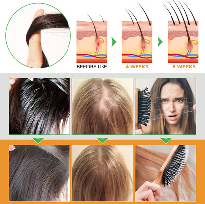 ALIVER 3in1 Shampoo + Conditioner (Rosemary &amp; Black Castor &amp; Batana)